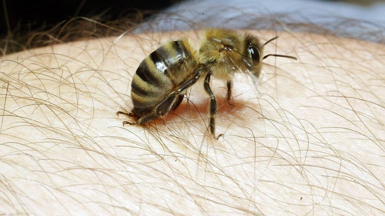 Biene: Nach einem Stich rötet sich die Haut um die Einstichstelle. Oft entsteht eine große Quaddel.