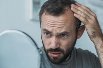 Schock beim Blick in den Spiegel: Bei vielen Männern ist Haarausfall genetisch bedingt.