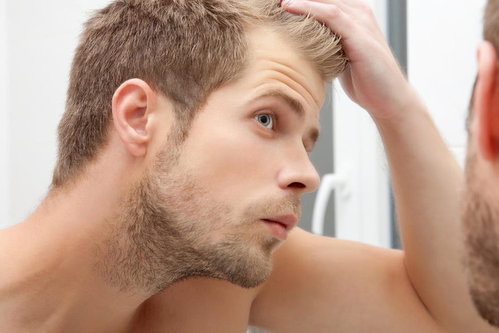 Erblich bedingter Haarausfall ist die häufigste Ursache für Haarverlust bei Männern.
