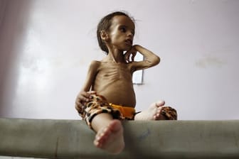 Ein unterernährtes Mädchen Bett in einem Krankenhaus in Jemens Hauptstadt Sanaa.