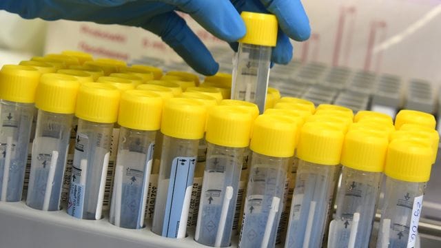 Im PCR-Labor bereitet eine medizinisch technische Laborassistentin die Bearbeitung von PCR-Tests vor. Im PCR-Labor bereitet eine medizinisch technische Laborassistentin die Bearbeitung von PCR-Tests vor.