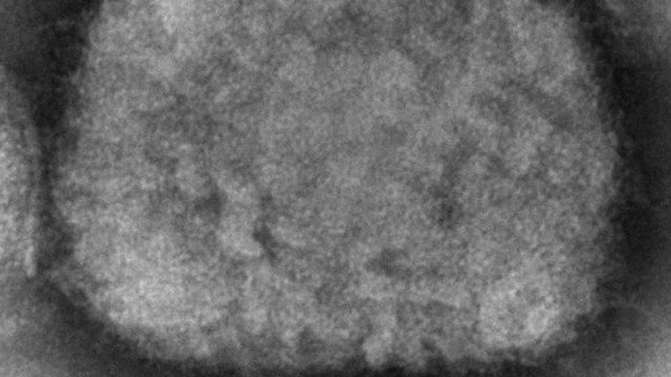 Diese elektronenmikroskopische Aufnahme zeigt ein Affenpockenvirus.