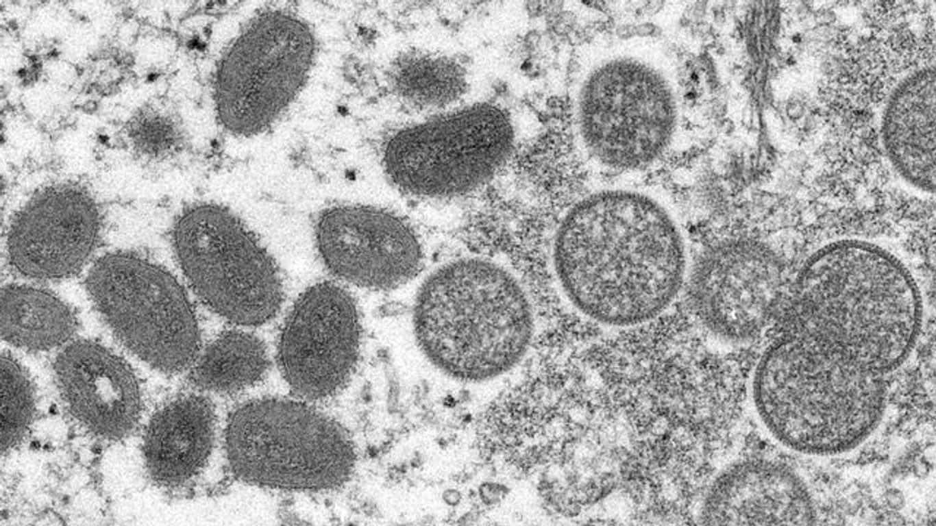 Diese elektronenmikroskopische Aufnahme zeigt reife, ovale Affenpockenviren (l) und kugelförmige unreife Virionen (r), die aus einer menschlichen Hautprobe stammt.