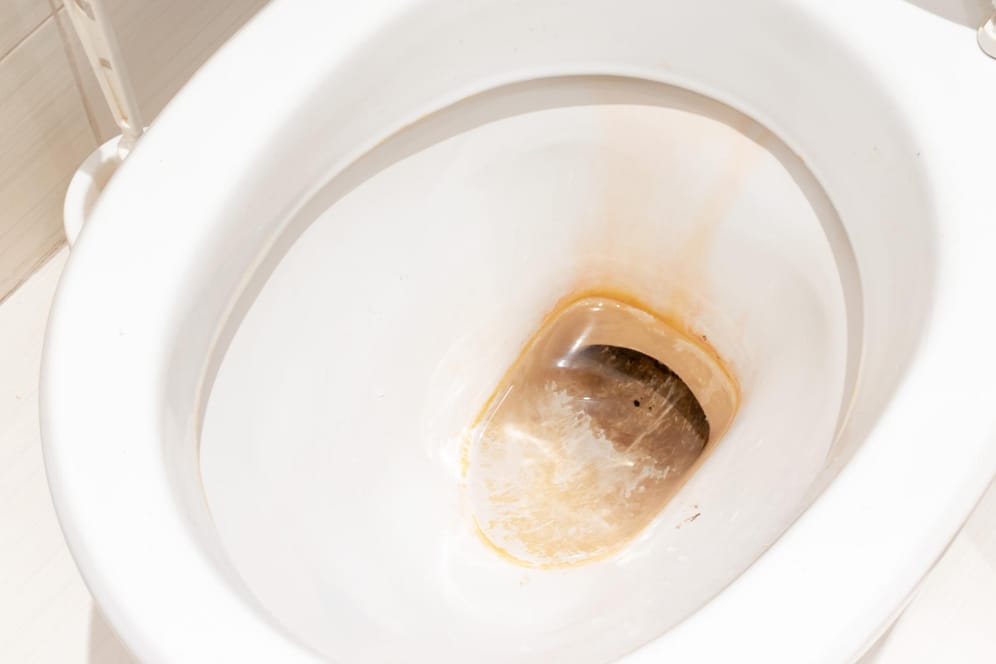 Schmutz: Wird die Toilette nicht gründlich genug gereinigt, können die braunen Ablagerungen sehr hartnäckig werden.
