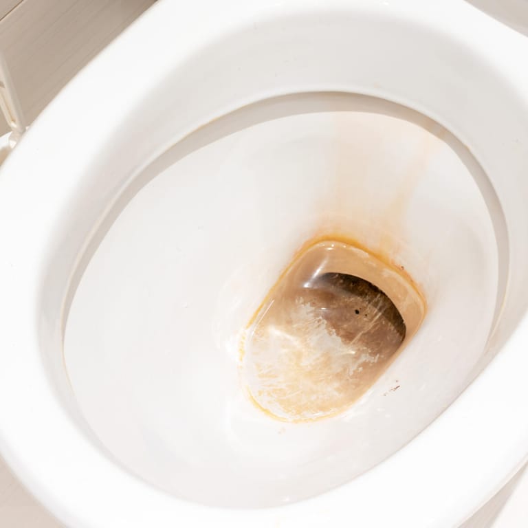 Schmutz: Wird die Toilette nicht gründlich genug gereinigt, können die braunen Ablagerungen sehr hartnäckig werden.