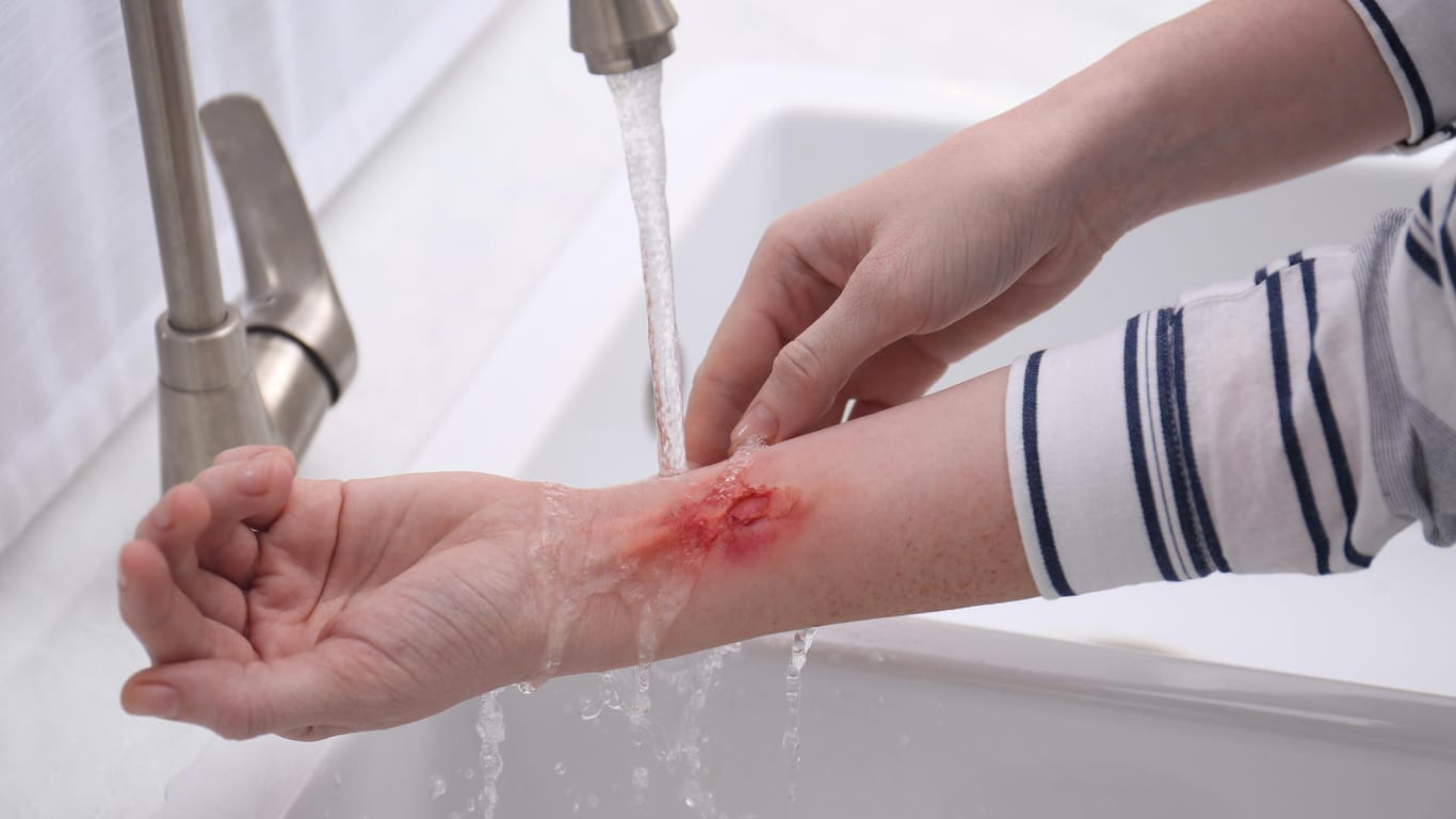 Eine Frau wäscht sich eine Wunde aus. Auch kleinere Wunden können sich infizieren und schwerwiegende Folgen haben.