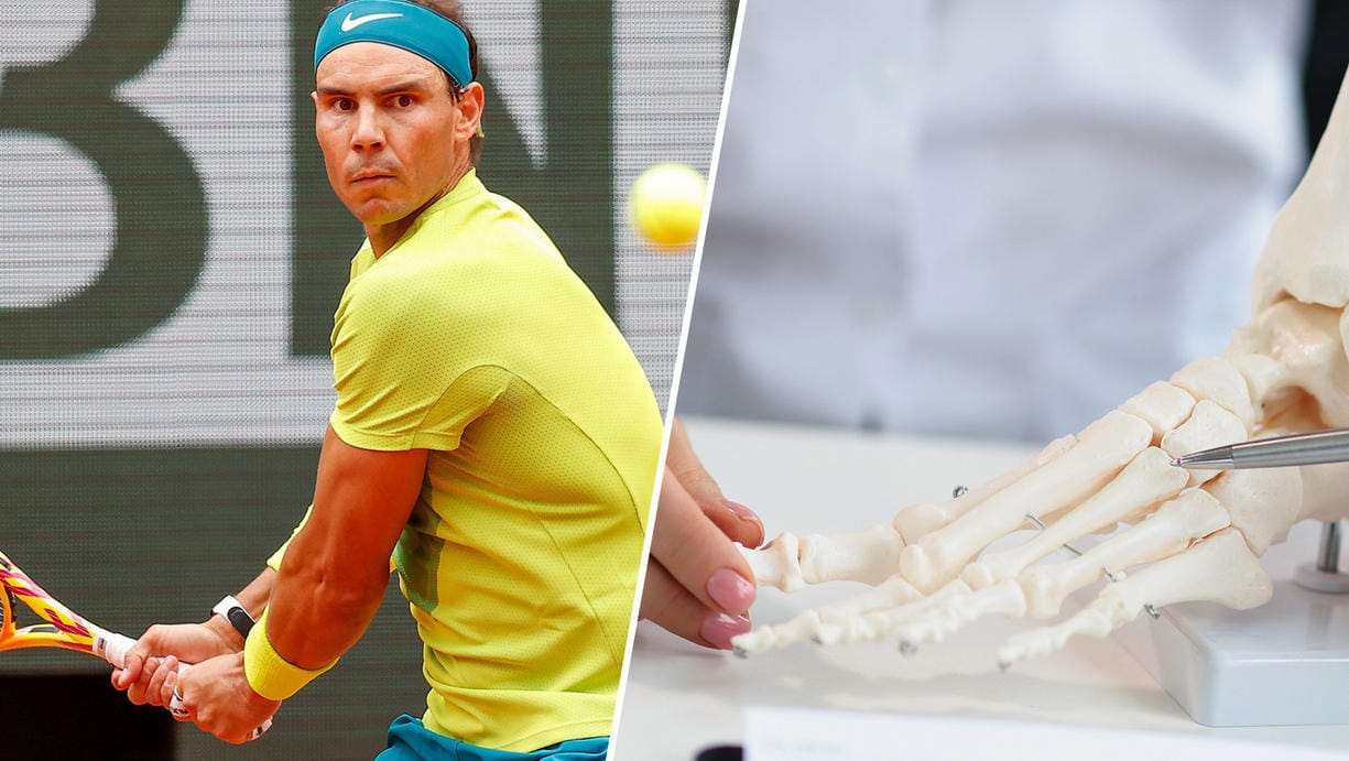 Rafael Nadal hat den Ball voll im Blick (li.): Der Spanier leidet seit Jahren schon am Müller-Weiss-Syndrom, das den Fuß in Mitleidenschaft zieht.