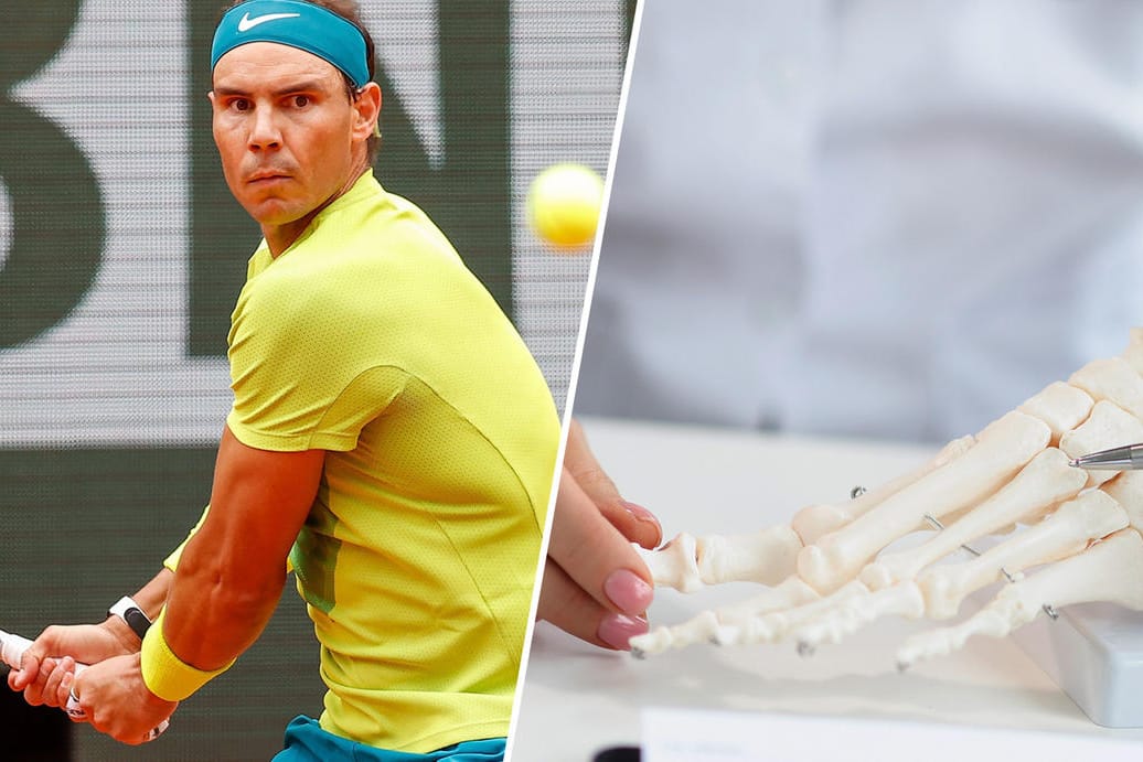 Rafael Nadal hat den Ball voll im Blick (li.): Der Spanier leidet seit Jahren schon am Müller-Weiss-Syndrom, das den Fuß in Mitleidenschaft zieht.