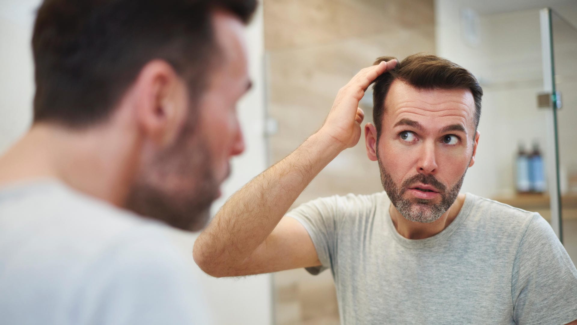 Geheimratsecken sind bei Männern oft die ersten Stellen, an denen sich Haarausfall zeigt.