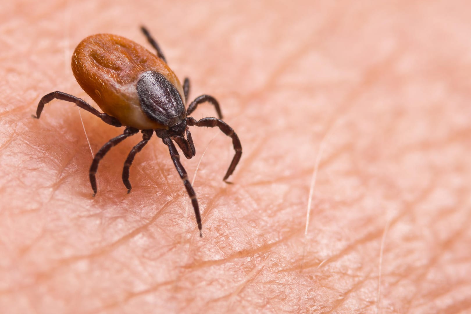 Zecke: Borreliose ist eine Krankheit mit welcher man sich durch einen Zeckenbiss infizieren kann.