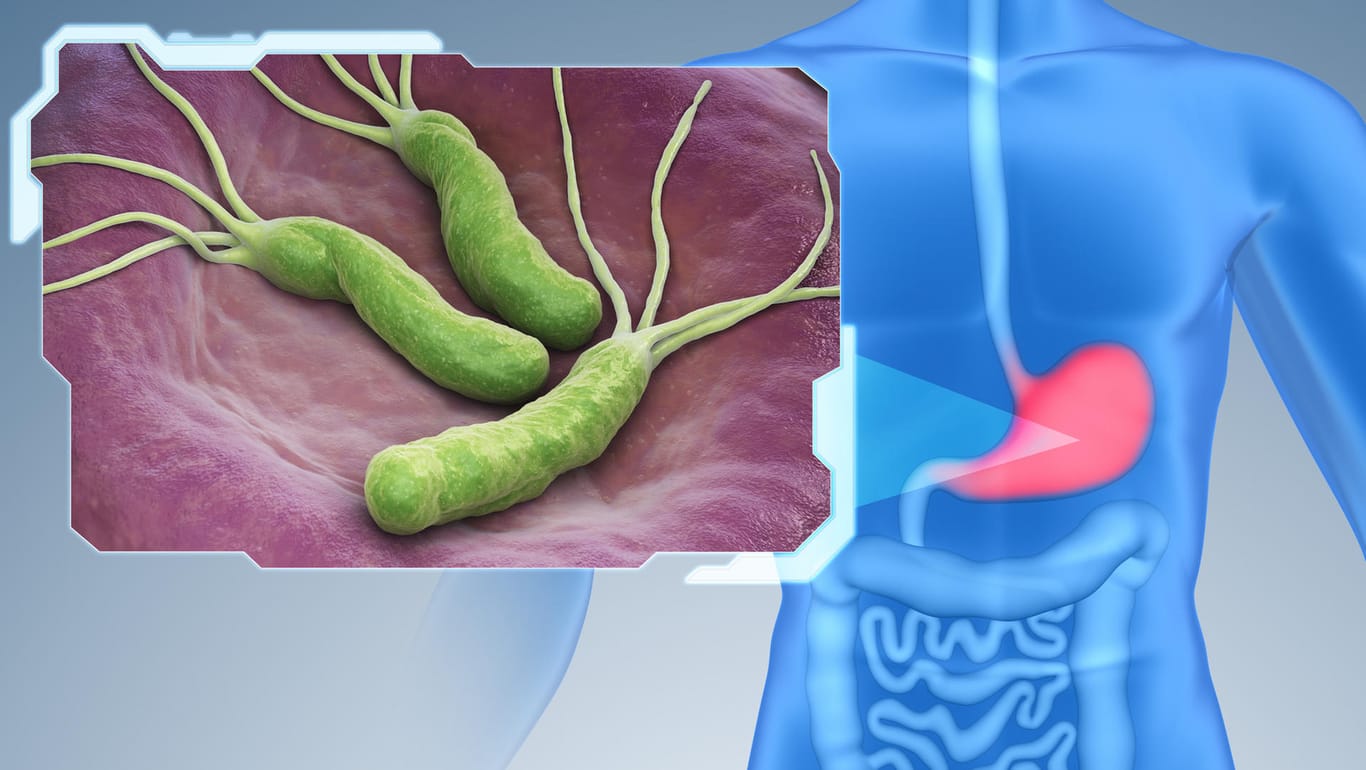 Abbildung des menschlichen Körpers mit der Speiseröhre, dem Magen-Darm-Trakt und weiteren Organen. Links daneben das stäbchenförmige Bakterium Helicobacter pylori.