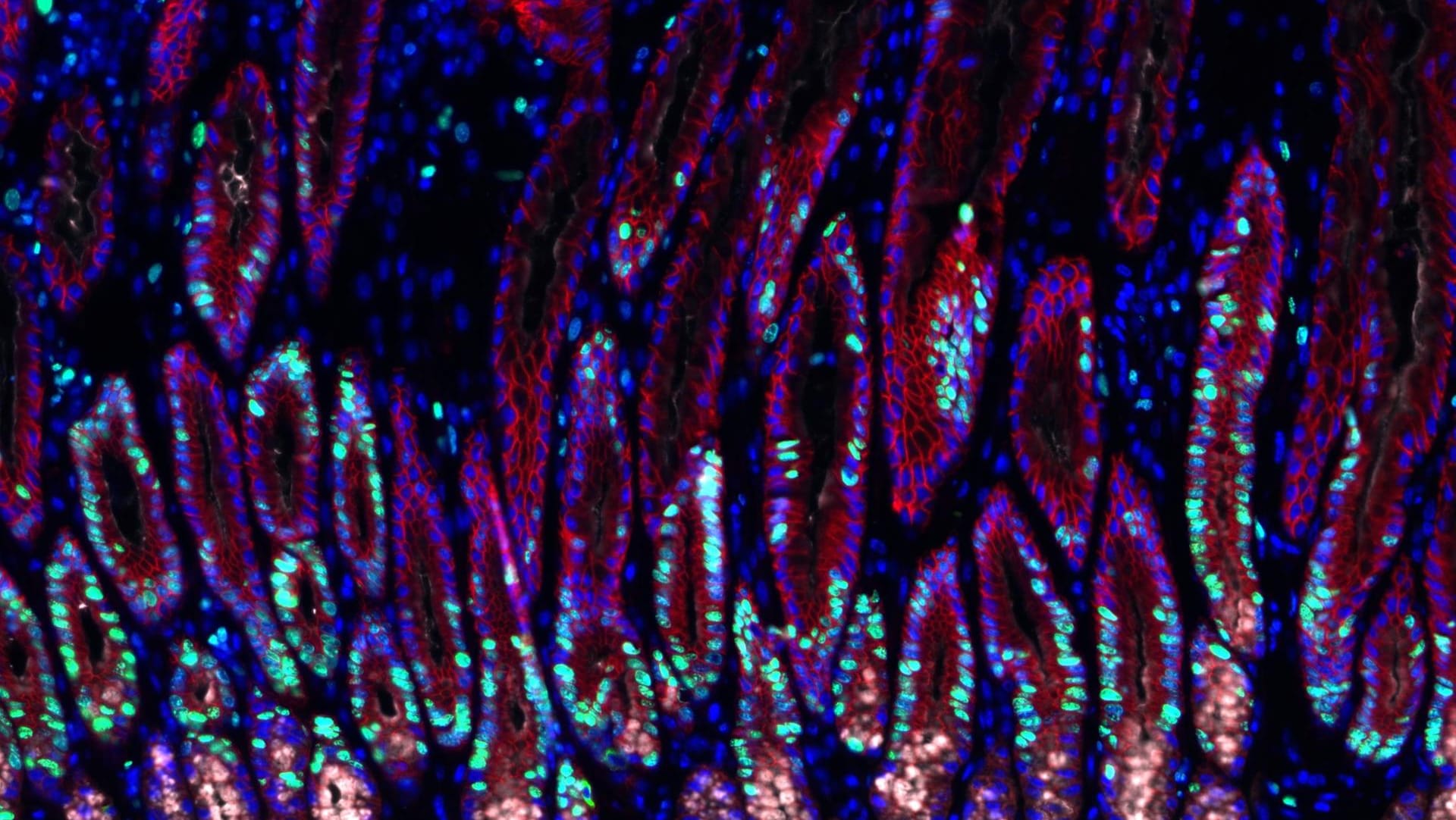 Mit Helicobacter-Bakterien infiziertes Magengewebe. Sich teilende Zellen sind grün, Zellkerne blau dargestellt.