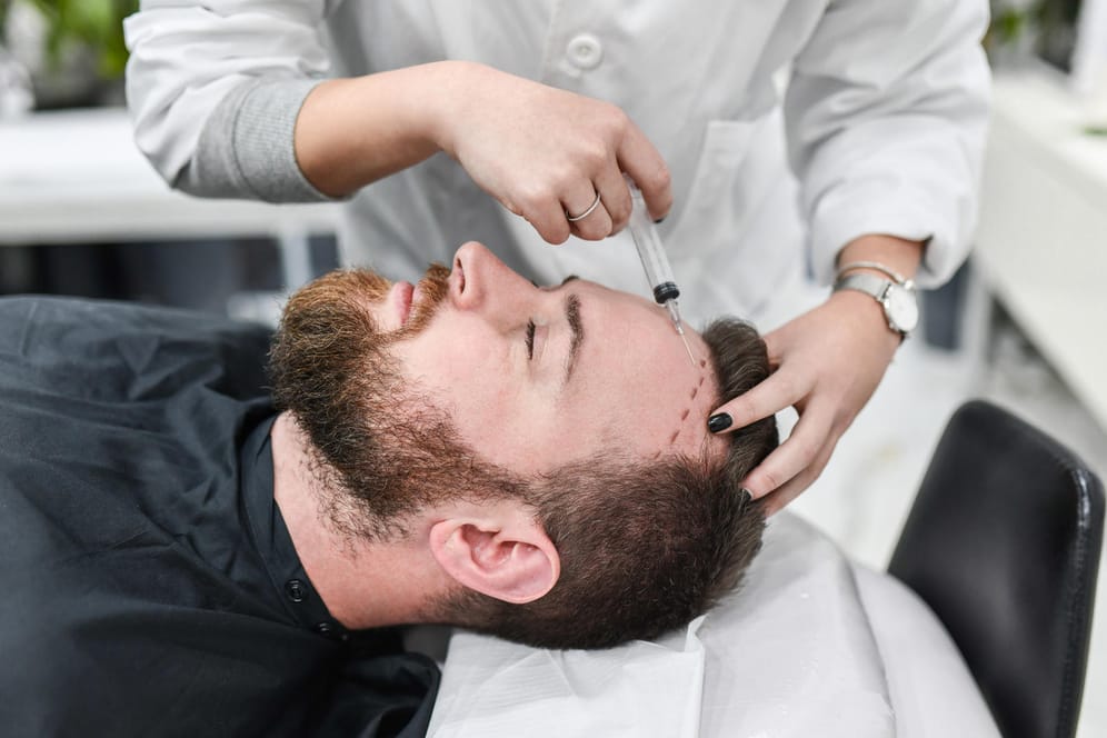 Junger Mann bei Haartransplantation: Immer mehr Männer mit starkem Haarausfall entscheiden sich für eine Transplantation der eigenen Haare.