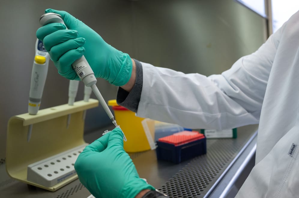 PCR-Test