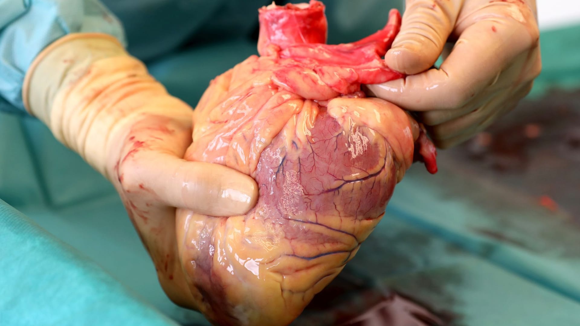 Organspende Organspende