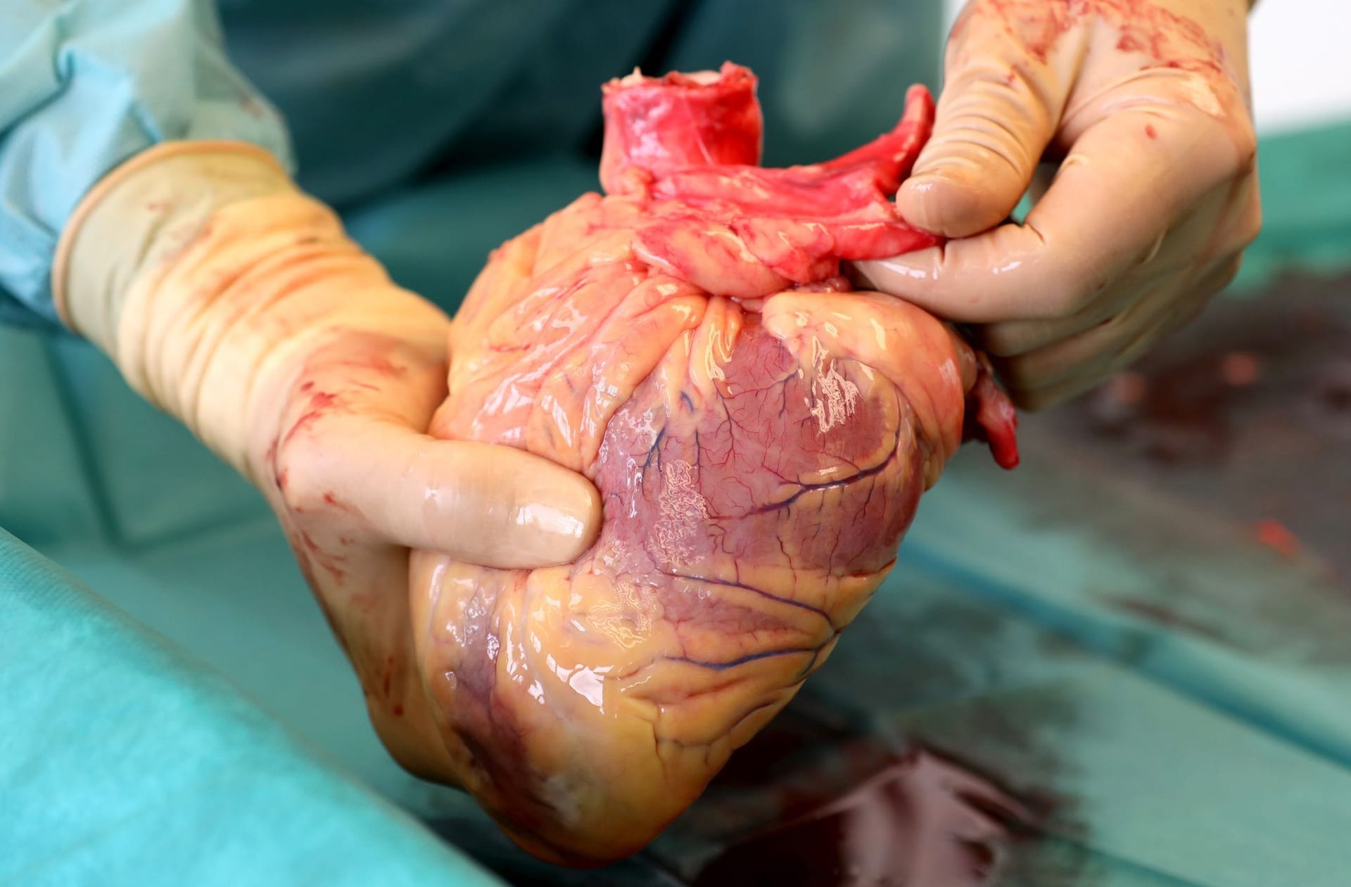 Organspende