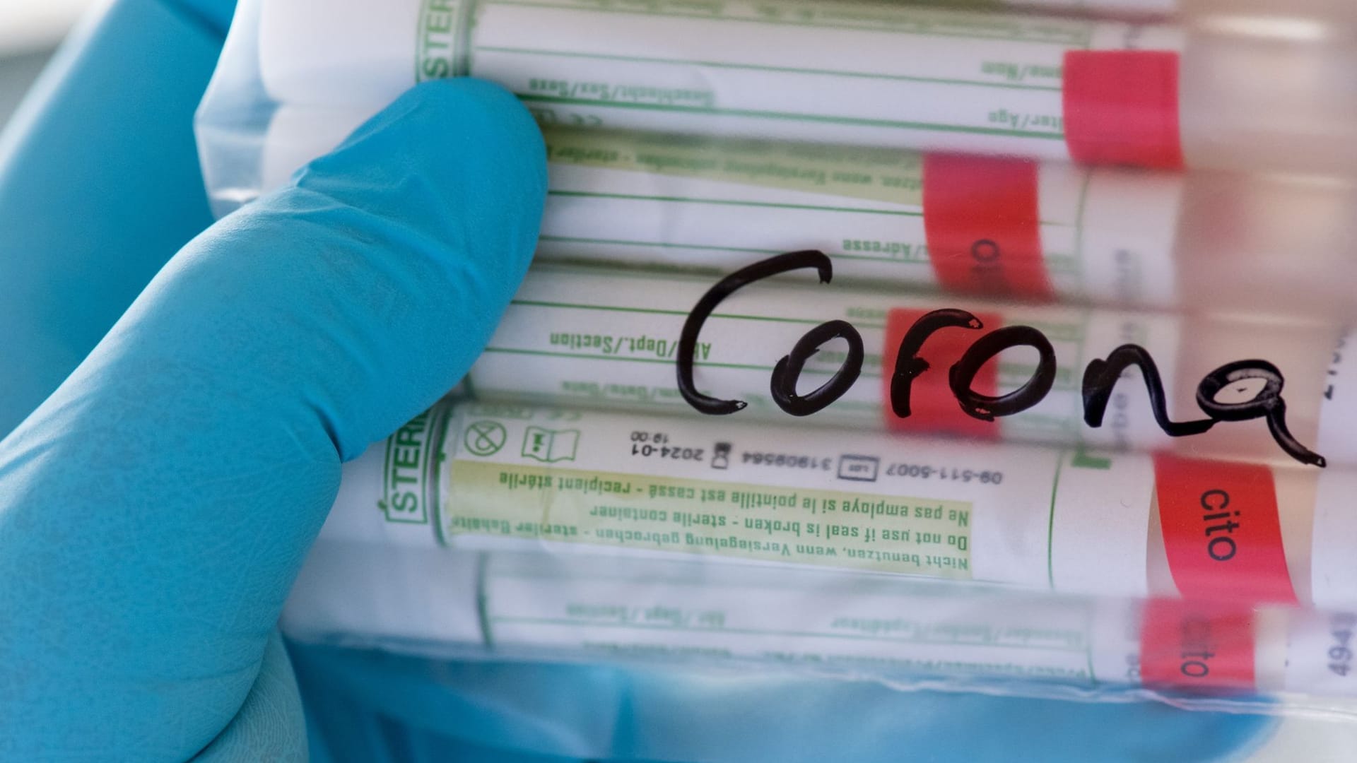 Corona-Tests Corona-Tests