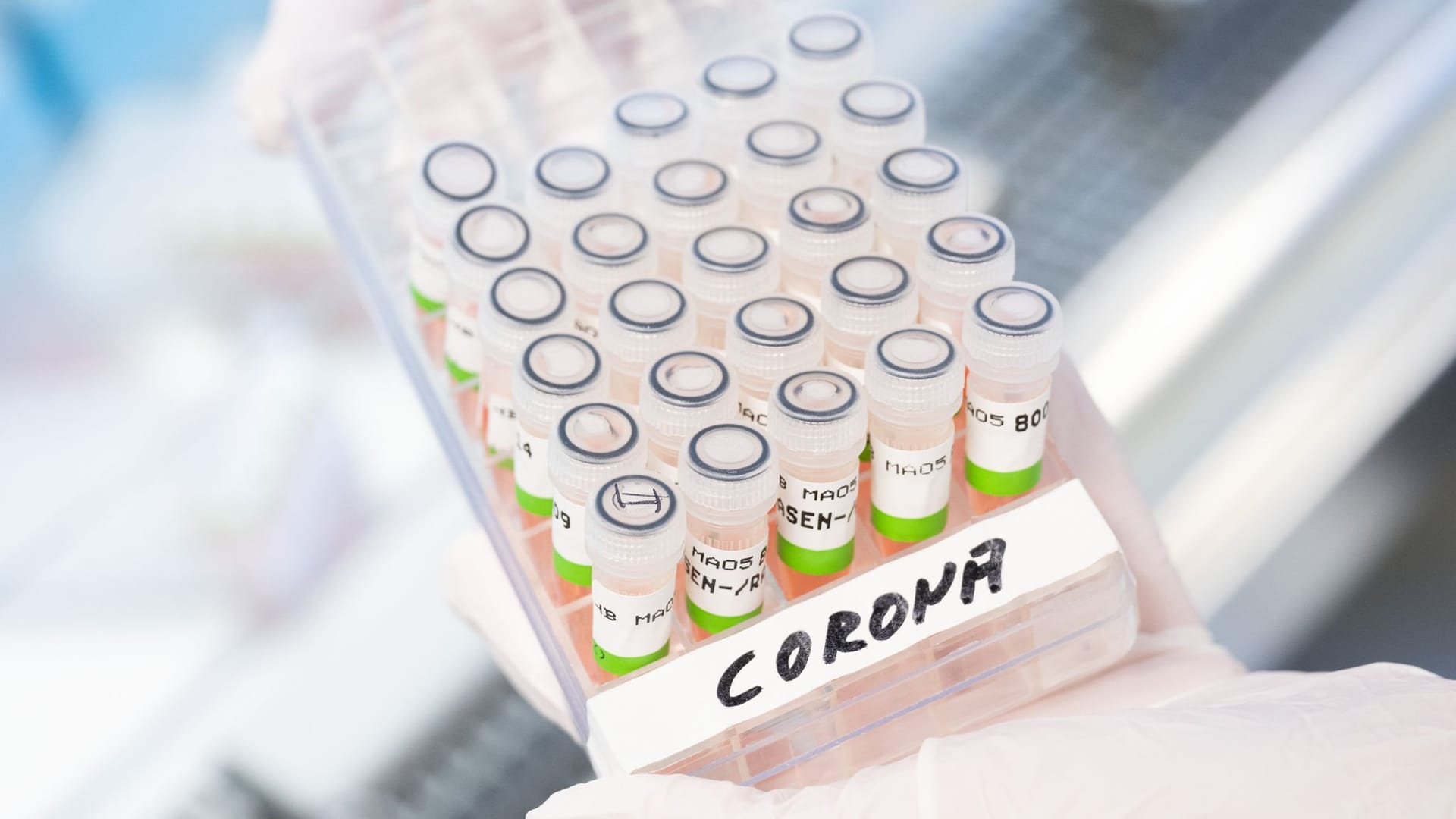 Gefäß mit aufbereiteten PCR-Tests auf das Coronavirus