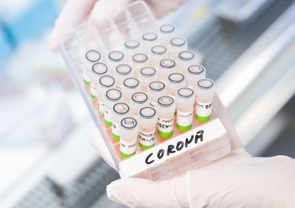 Gefäß mit aufbereiteten PCR-Tests auf das Coronavirus