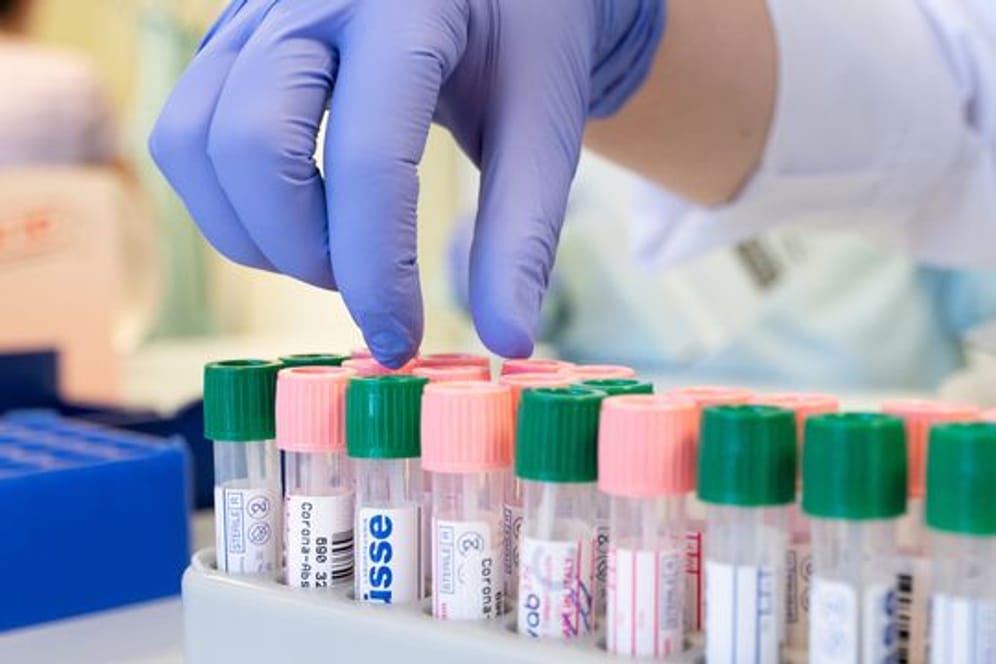 Labormitarbeiterinnen etikettieren im Medizinischen Labor Ostsachsen Corona-Abstriche zum Virusnachweis mit der PCR-Methode.