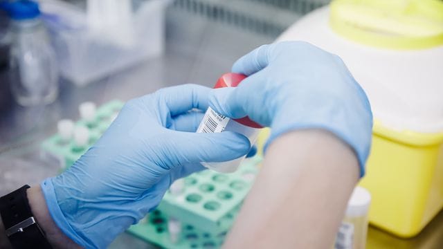 Eine Krankenschwester führt im Krankenhaus Ramon y Cajal in Madrid einen PCR-Test zur Erkennung des Affenpockenvirus durch. Eine Krankenschwester führt im Krankenhaus Ramon y Cajal in Madrid einen PCR-Test zur Erkennung des Affenpockenvirus durch.