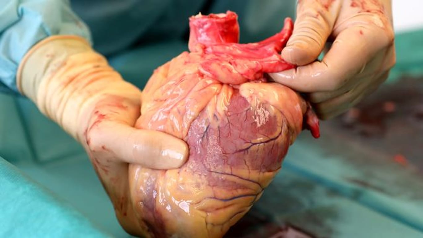 Ein Transplantationsmediziner hält das Herz eines Verstorbenen in den Händen, das kurz zuvor entnommen wurde.