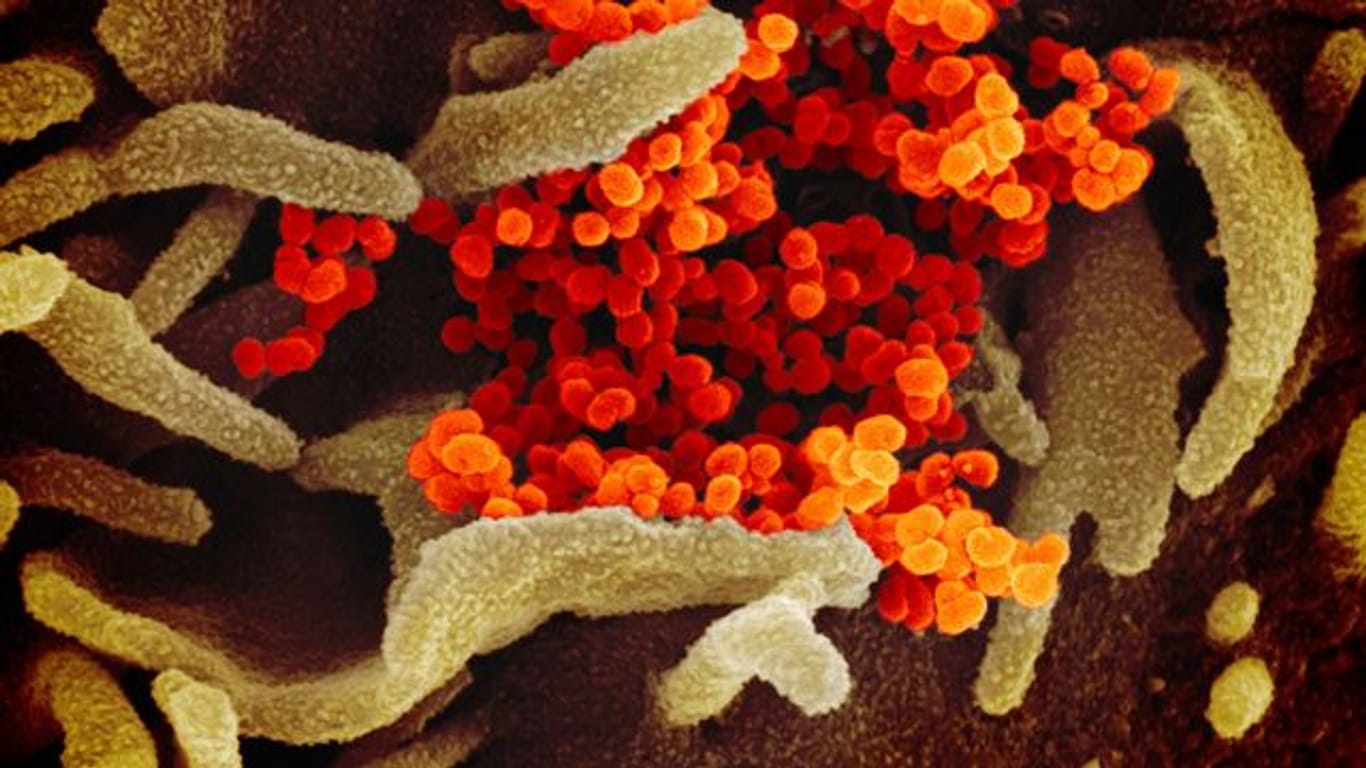 Das Coronavirus (SARS-CoV-2) (orange), das aus der Oberfläche von im Labor kultivierten Zellen (grau) austritt.