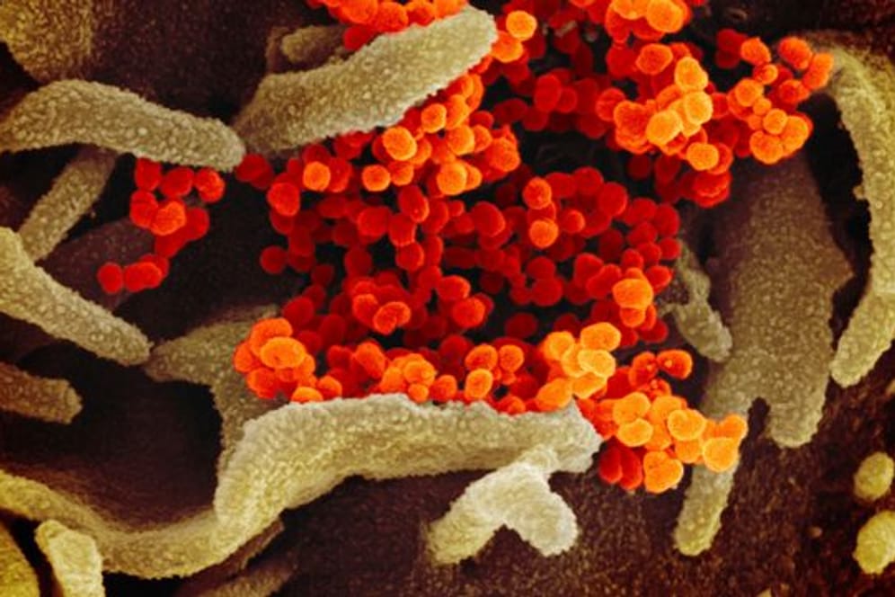 Das Coronavirus (SARS-CoV-2) (orange), das aus der Oberfläche von im Labor kultivierten Zellen (grau) austritt.