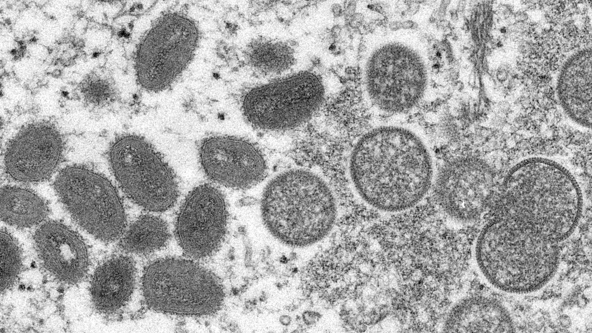 Elektronenmikroskopische Aufnahme von Affenpockenviren (Archivbild): Nun kann auch in Deutschland gegen das Virus geimpft werden.