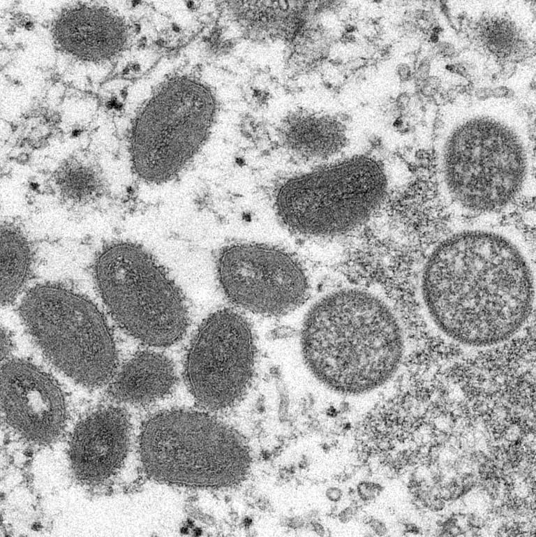 Elektronenmikroskopische Aufnahme von Affenpockenviren (Archivbild): Nun kann auch in Deutschland gegen das Virus geimpft werden.