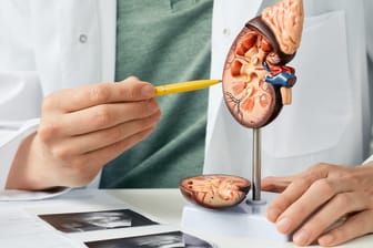 Ein Arzt deutet mit einem Stift auf das anatomische Modell einer Niere.