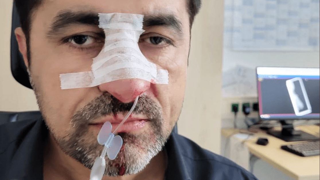 Lokalpolitiker Halil Tasdelen wurde Opfer eines rassistischen Angriffs. Lokalpolitiker Halil Tasdelen wurde Opfer eines rassistischen Angriffs.