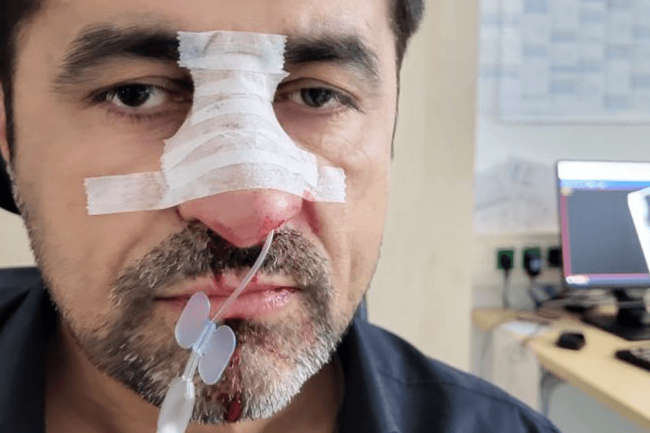 Lokalpolitiker Halil Tasdelen wurde Opfer eines rassistischen Angriffs.