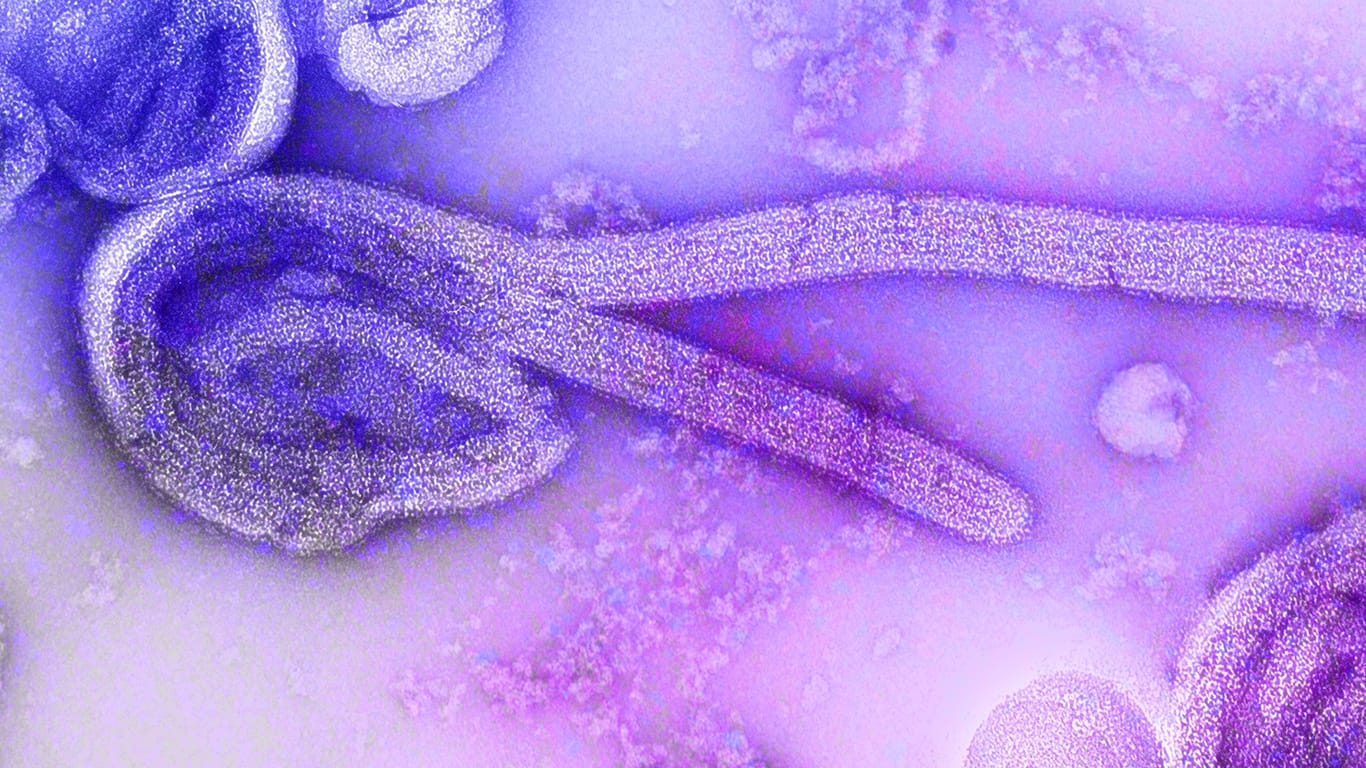 Gefährliche Krankheit: Eine elektronenmikroskopische Aufnahme des Marburg-Virus.
