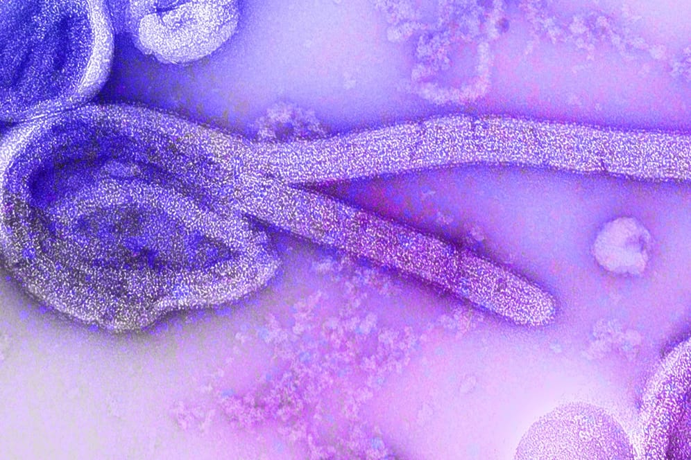 Gefährliche Krankheit: Eine elektronenmikroskopische Aufnahme des Marburg-Virus.