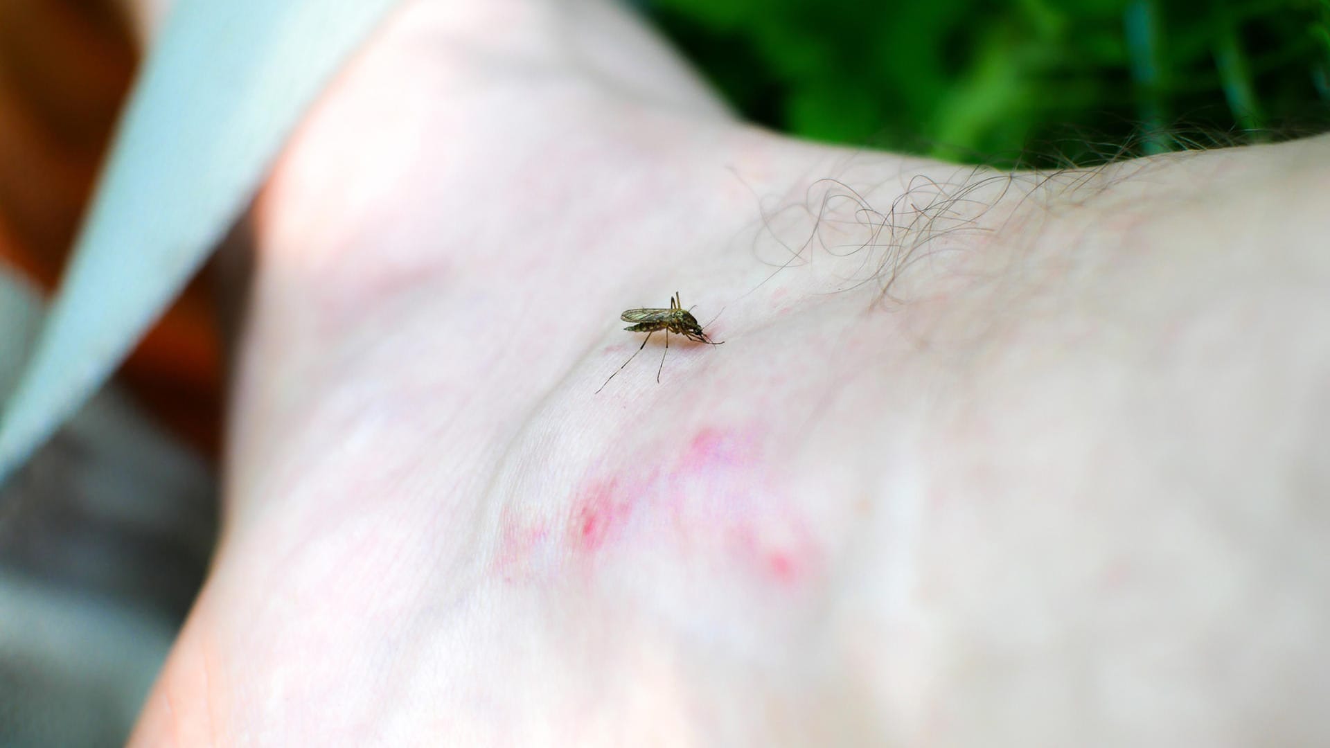 Mücke: Die Stiche können auch Entzündungen hervorrufen.