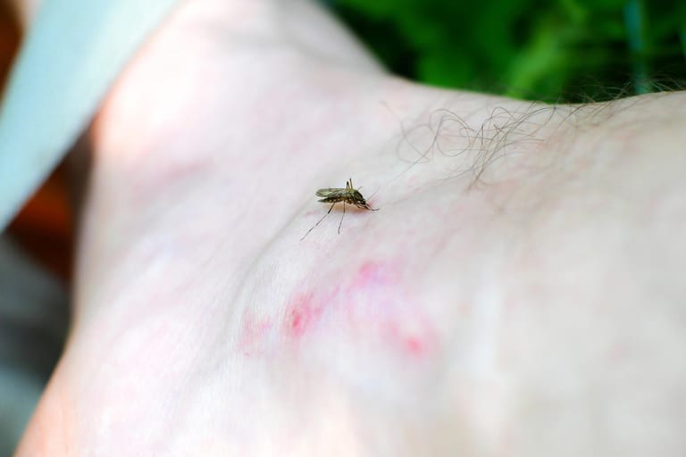 Mücke: Die Stiche können auch Entzündungen hervorrufen.