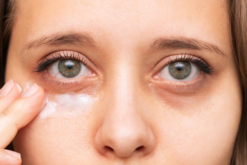Frau trägt Augencreme auf Augenringe auf: Augencremes versorgen die Haut unter den Augen mit Feuchtigkeit und haben einen glättenden Effekt. Die untere Augenpartie wirkt dadurch voller und die dunklen Schatten lassen sich besser abdecken.