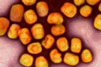 Ein koloriertes Mikroskopbild von Partikeln des Affenpockenvirus: Die EU fordert von den Mitgliedsstaaten eine bessere Vorbereitung.
