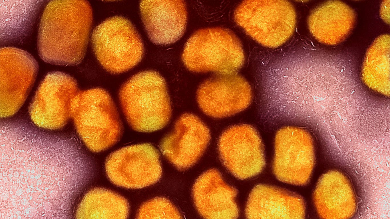 Ein koloriertes Mikroskopbild von Partikeln des Affenpockenvirus: Die EU fordert von den Mitgliedsstaaten eine bessere Vorbereitung.