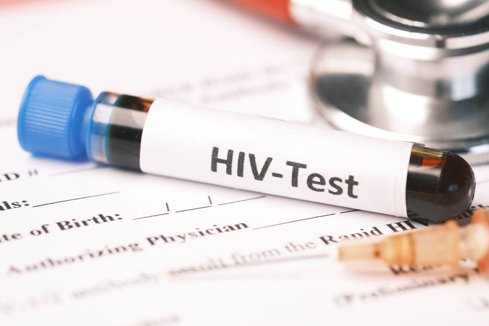 HIV-Test (Symbolbild): Der Kampf gegen Aids gerät laut UN ins Stocken.