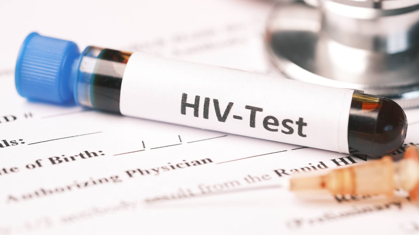 HIV-Test (Symbolbild): Wer positiv auf HIV getestet wird, hat inzwischen gute Therapiemöglichkeiten.