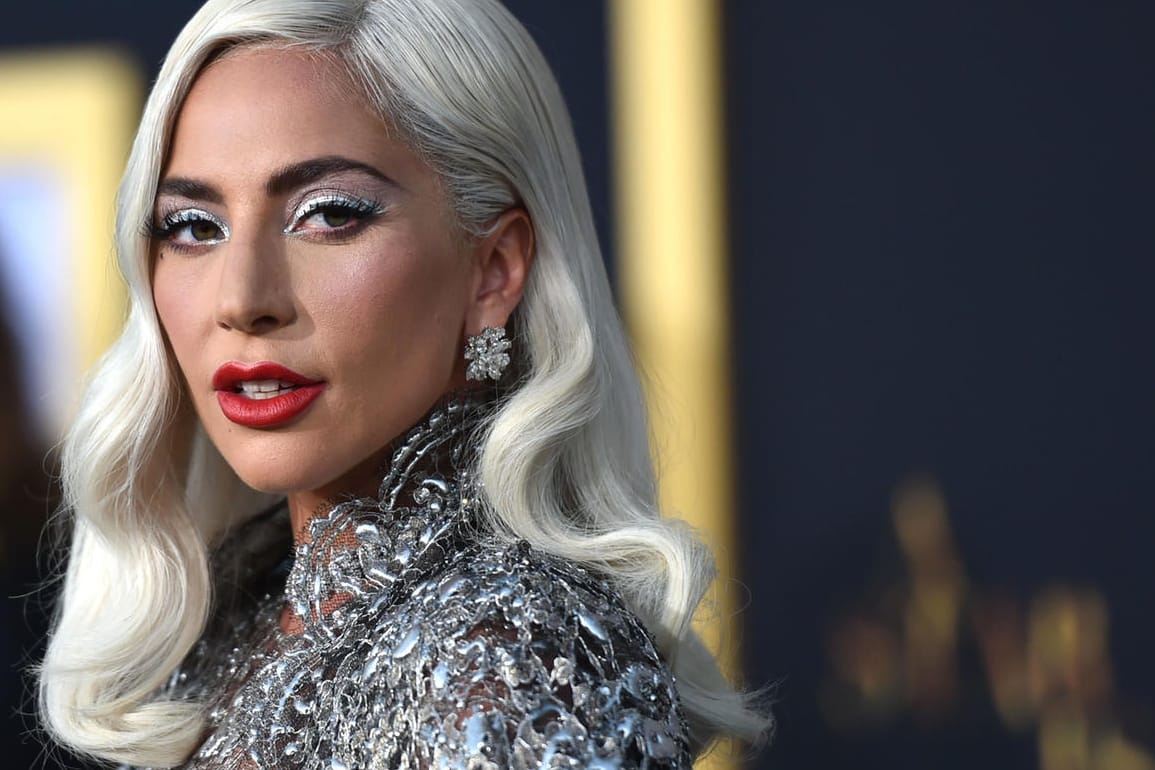 Lady Gaga: Die Sängerin musste um ihre geliebten Hunde bangen.