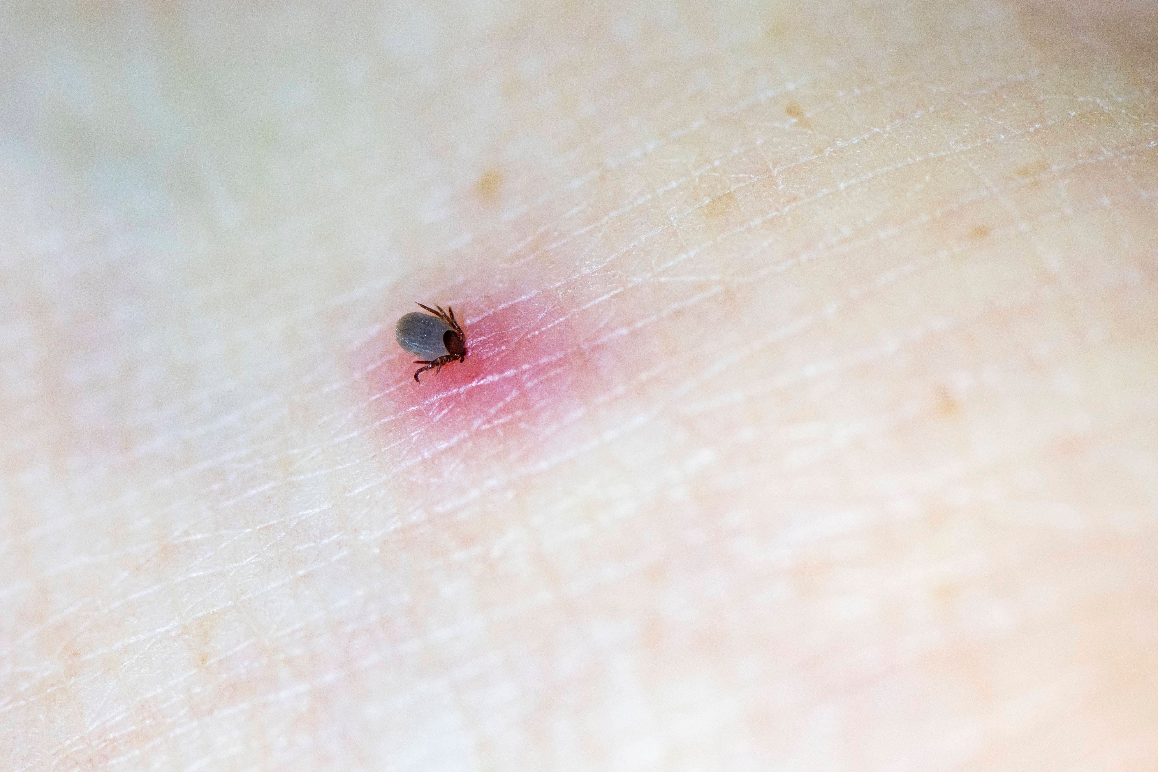 Insektenstich Welches Insekt hat mich gestochen?