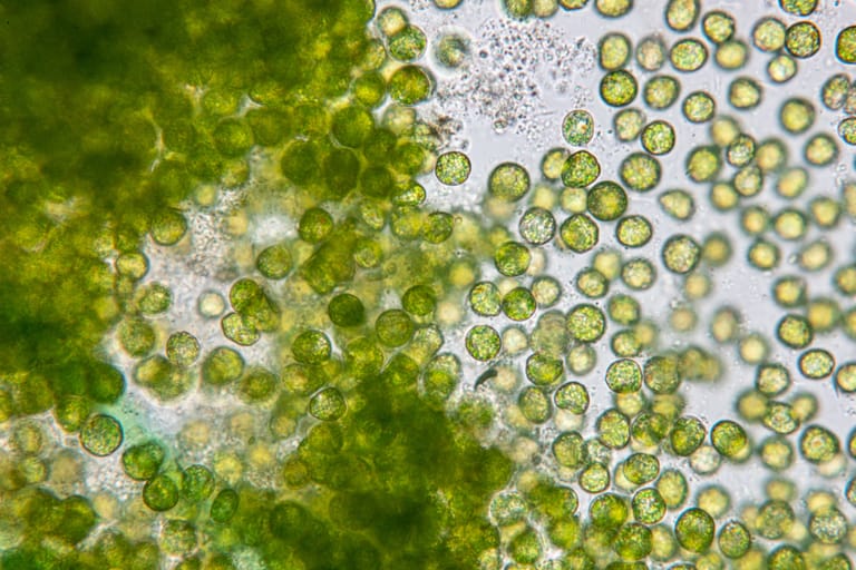 Eine Algenzelle unter dem Mikroskop: Forscher vermuten eine Wasserpflanze als Ursache des Fischsterbens in der Oder.