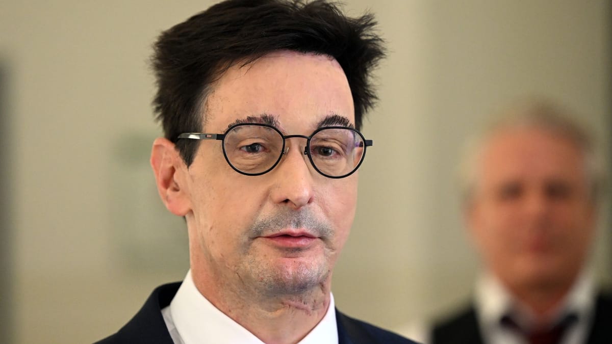 Säureattentat auf Topmanager: Bernhard Günther lobt hohe Belohnung aus