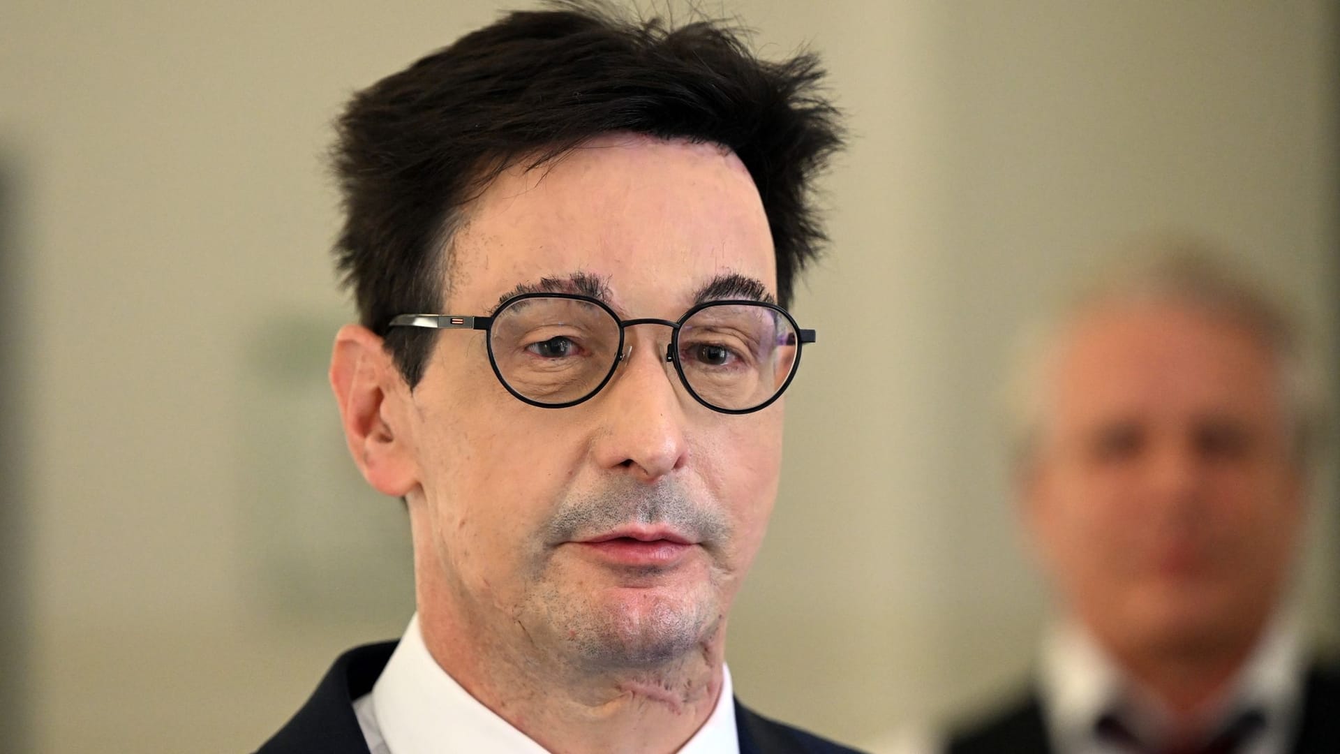 Prozess um Säureanschlag auf Topmanager