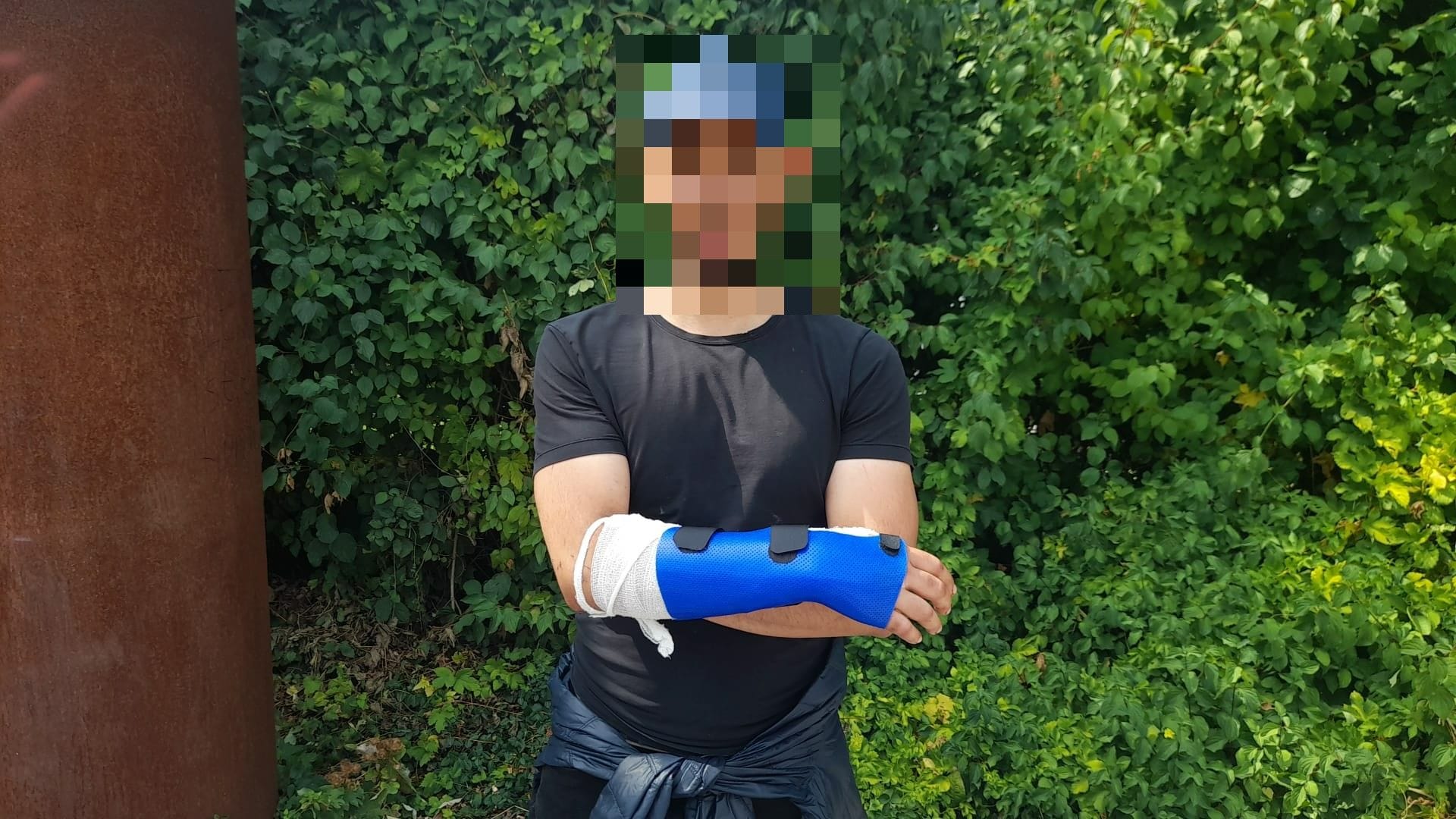 Der 26-jährige S. mit seinem verletzten Arm. Er muss nun mehrere Wochen einen Gips tragen.