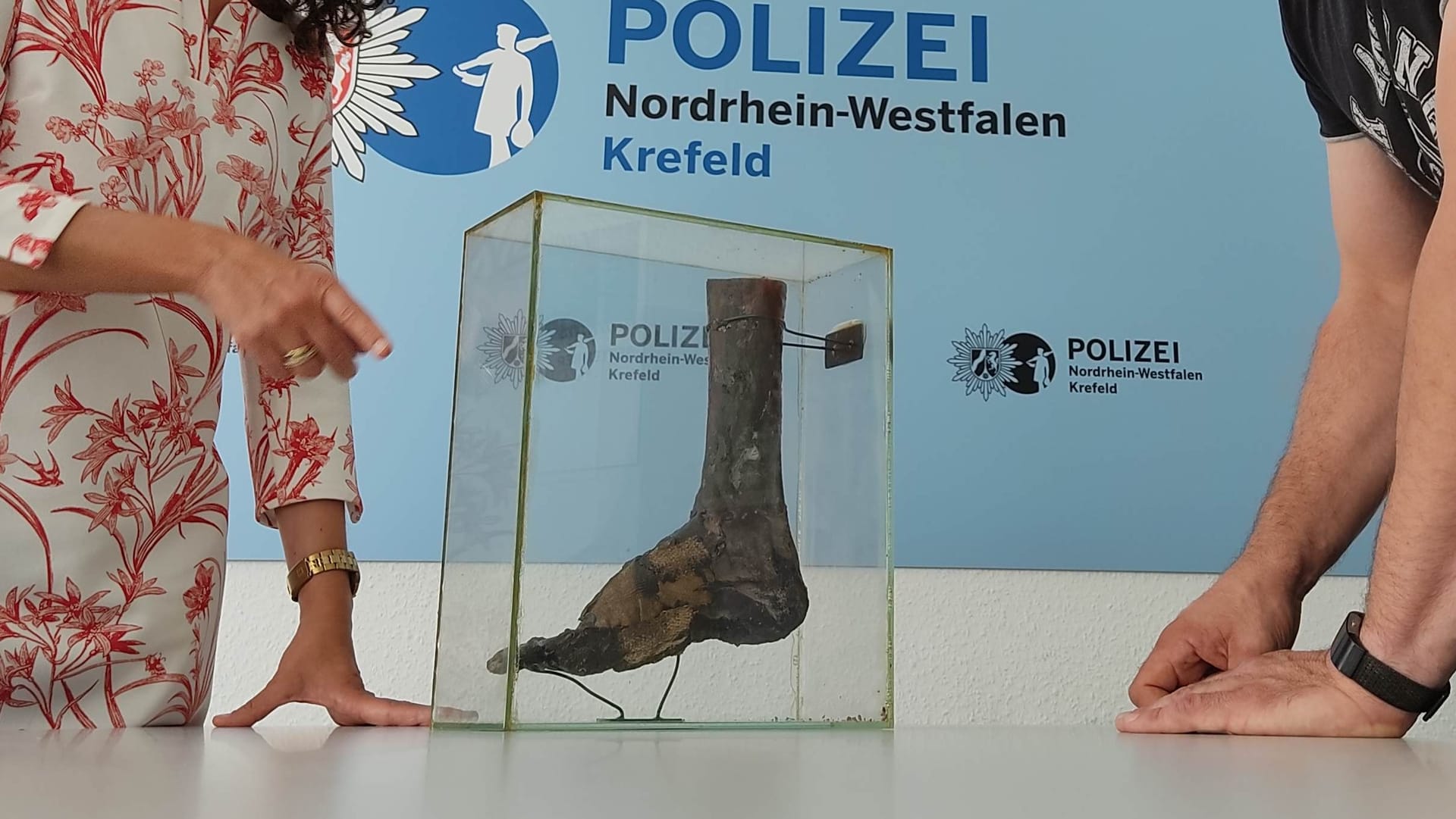 Unterschenkel und Fuß im Schaukasten: Er gelangte offenbar nach einer Urlaubsreise in Krefeld.