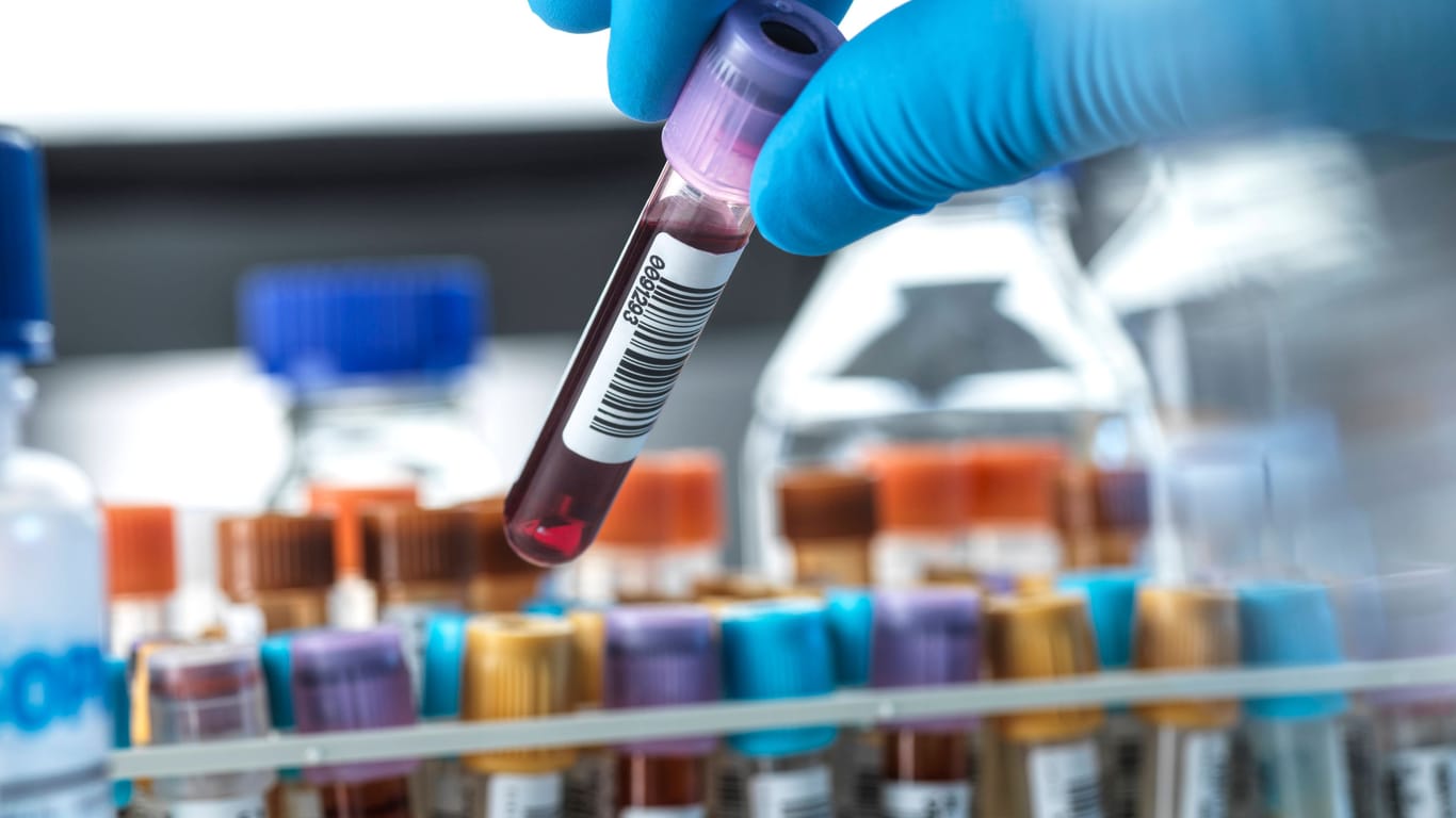 Blutproben: Ein neuer Test erkennt die Tumor-DNA und wo der Tumor im Körper sitzt.